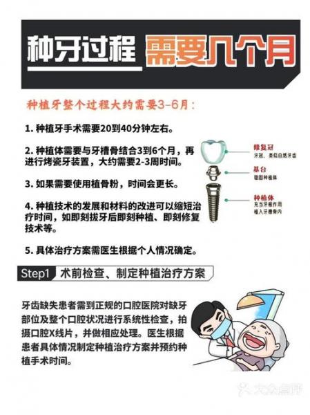 种植牙的全部过程及时间,种植牙步骤和阶段时间