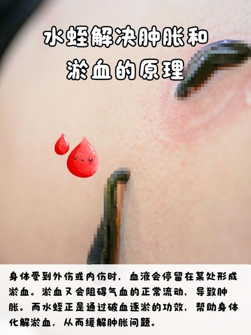 水蛭养殖喂什么?水蛭养殖技术吃什么?