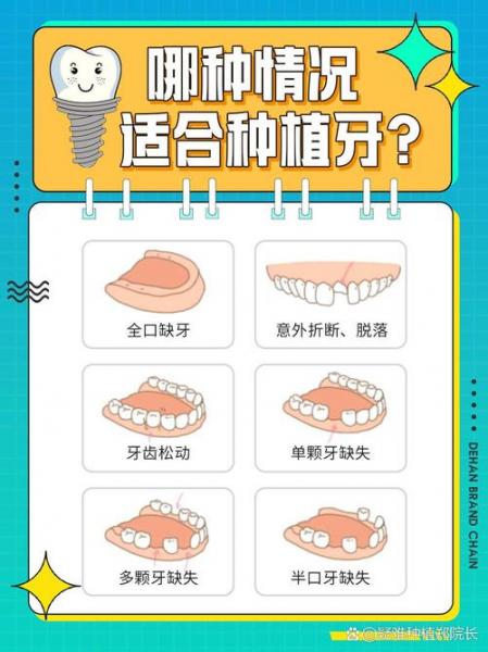 上门牙为什么不建议种植?上门牙为什么不建议种植来武汉中诺专家坐诊?